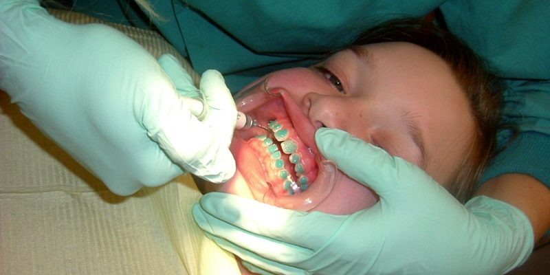 Orthodontist - Navarro Dentist