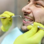 The Different Phases of Orthodontic Treatment