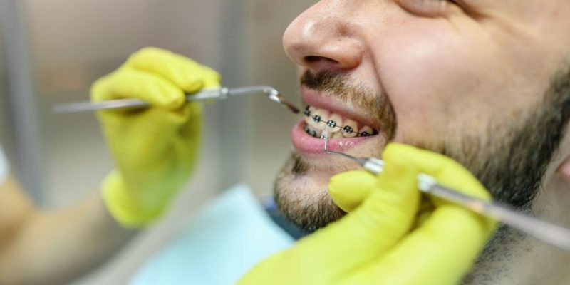 The Different Phases of Orthodontic Treatment