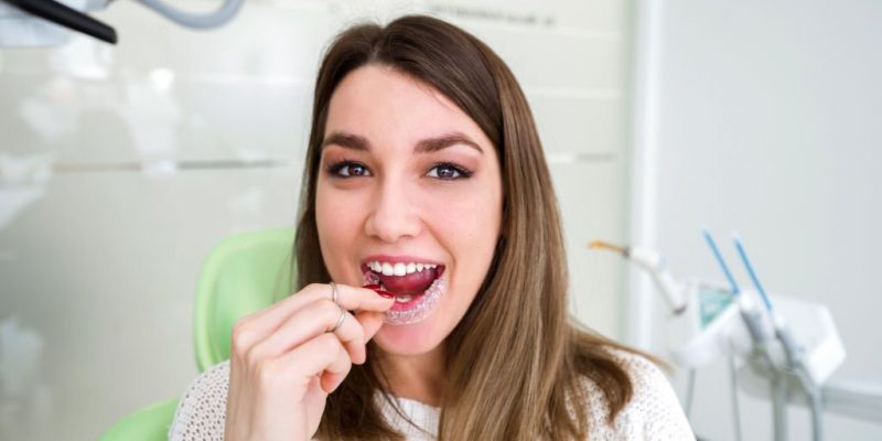 Understand the Invisalign Braces Dental Treatment Process