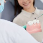 How Do Dental Implants Work