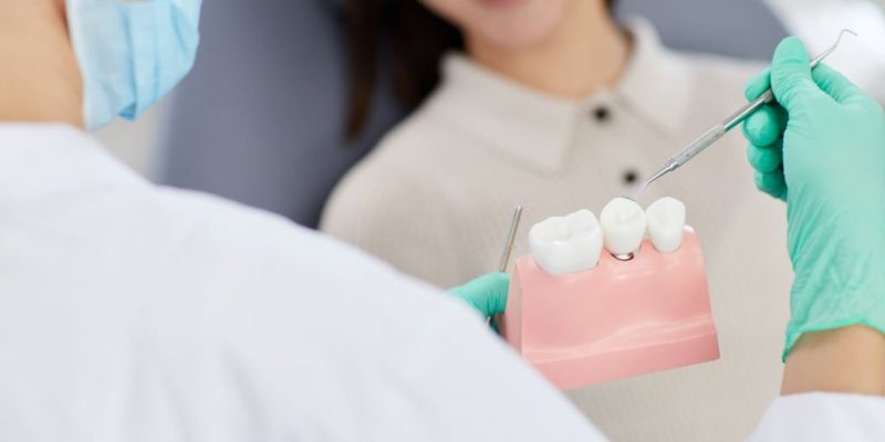 How Do Dental Implants Work