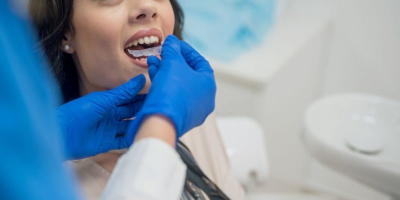 What Is The Step-By-Step Invisalign Treatment Process?