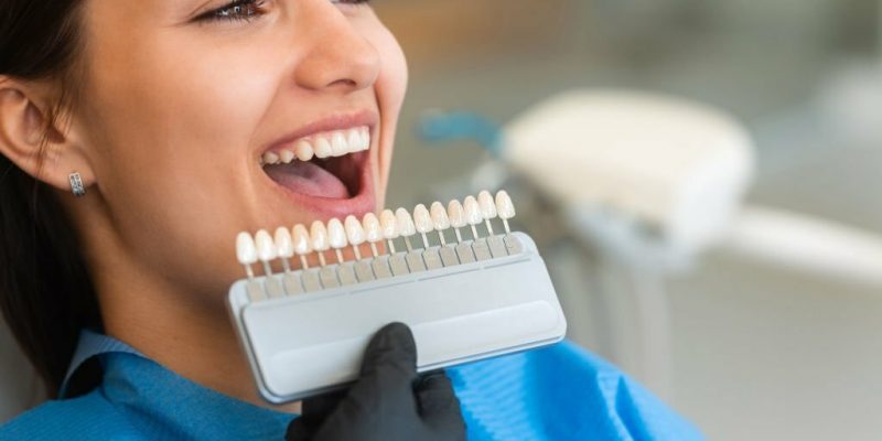 How Do Veneers Work? Do They Feel Normal?